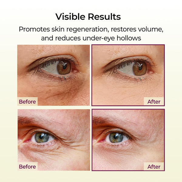 Calcium Volume Repair Face Balm